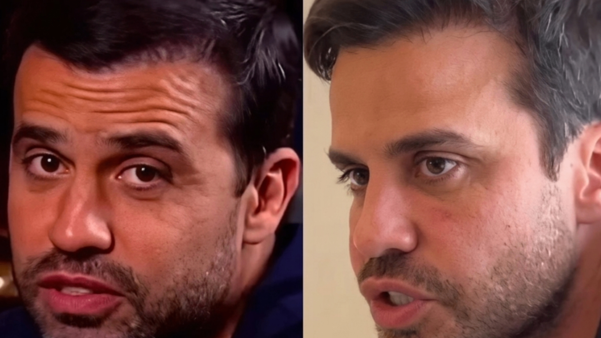 Procedimento de Toxina Botulínica de Face e Pescoço